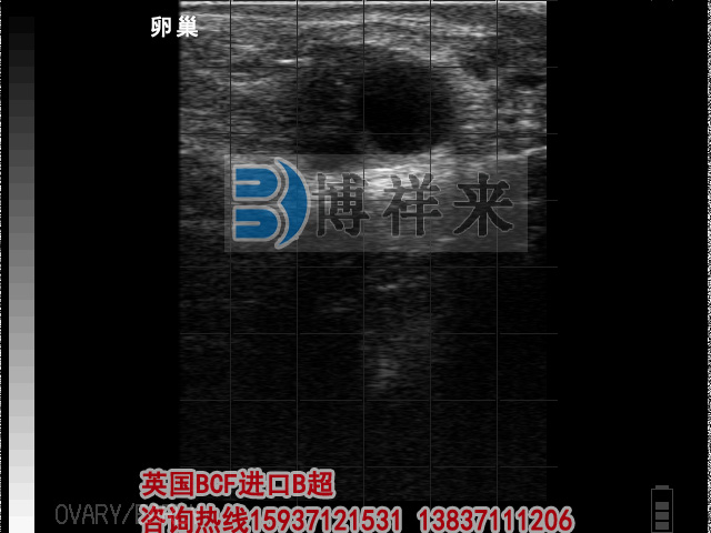 牛用B超檢測奶牛卵巢圖像