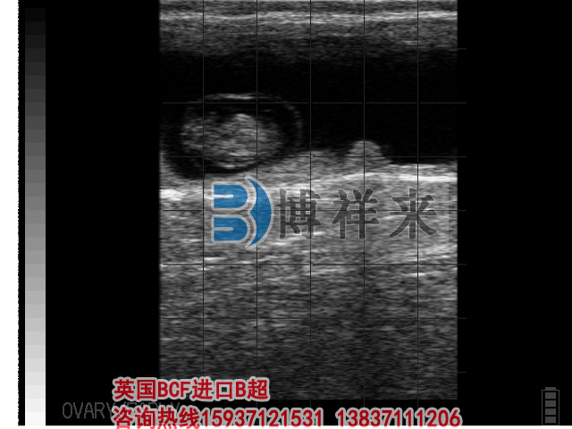牛用B超檢測孕期胎盤(pán)影像圖