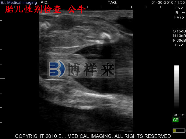 牛用B超，奶牛B超學(xué)習，奶牛懷孕60天B超影像學(xué)習